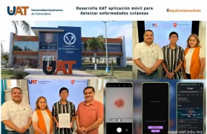 UAT desarrolla una aplicación móvil para detectar enfermedades de la piel